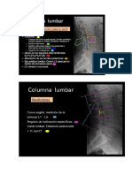 Columna Sacrolumbar Exposion TC Radiologica
