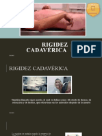 Rígidez Cadavérica