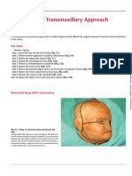 Transfacial Transmaxillary Approach: Key Steps