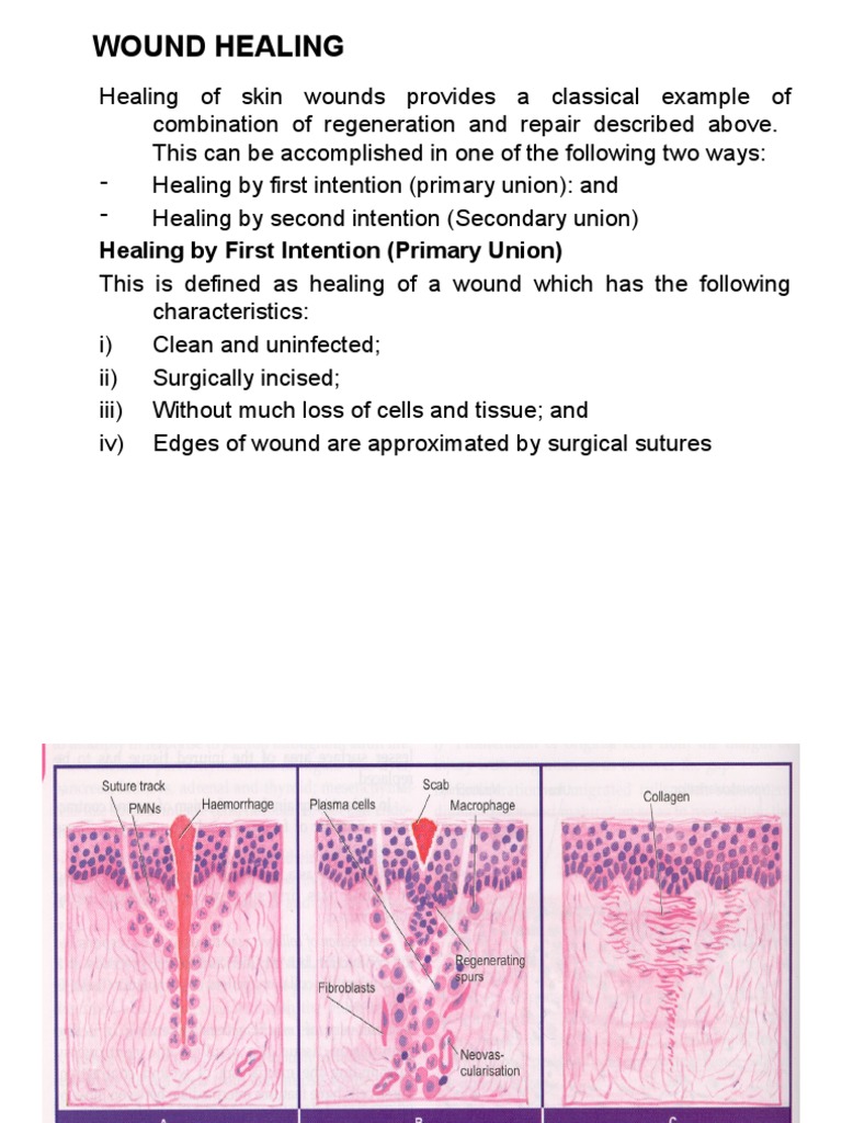 Wound Healing: Healing by First Intention (Primary Union) | PDF | Wound ...