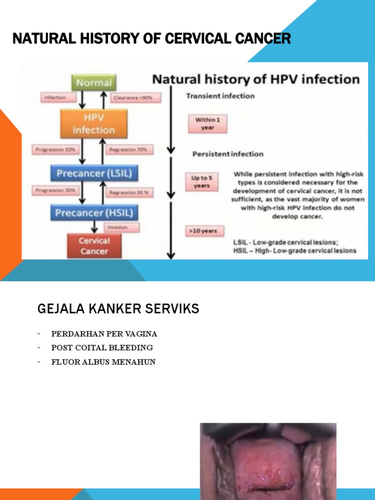 Natural History Of Cervical Cancer Pdf