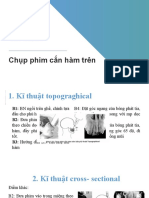 Chụp phim cắn hàm trên: Tổ 4-RHM4B