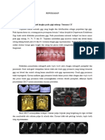 Ringkasan Jurnal Fissure Sealent (Nurul Annisa)