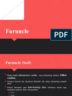 Furuncle Boil Guide: Causes, Symptoms & Treatment