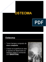 2) OSTEOMA