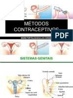 2078metodos Contraceptivos