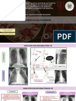 Tuberculosis y Micosis Pulmonar