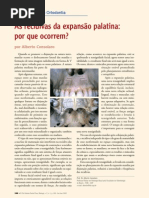 As recidivas da expansão palatina por que ocorrem