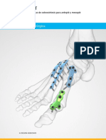 Acumed Surgical Technique ES Locking Forefoot Midfoot ESLEX00 03 B