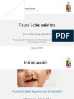 fisura-labiopalatina-dra-paulina-ortega-caballero_archivo