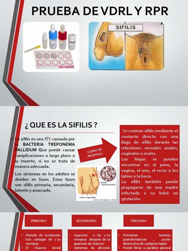Pruebas VDRL y RPR para Sífilis | PDF | Microbiología | Epidemiología