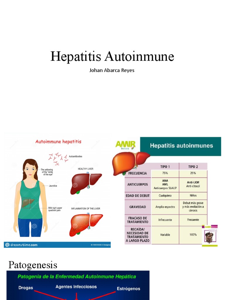 Hepatitis Autoinmune PDF