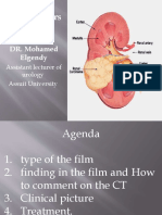 Renal Tumors: DR. Mohamed Elgendy