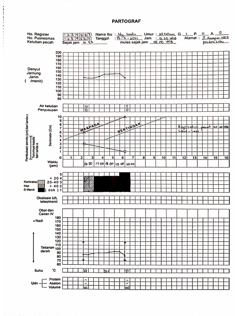 Tugas Partograf 2 | PDF