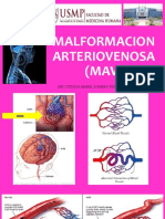 Malformaciones Arteriovenosas