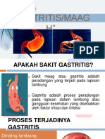 Gastritis 190119103328