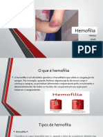 Hemofilia Heloisa