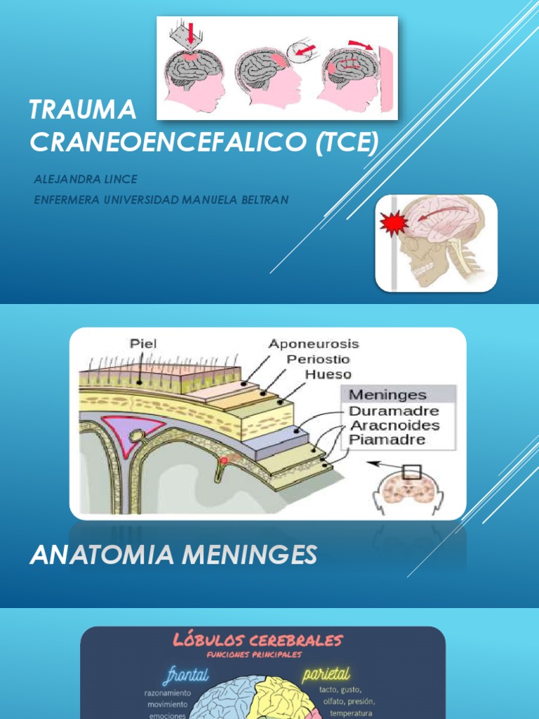 Trauma Craneoencefalico (Tce) | PDF | Lesión cerebral traumática ...