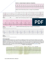 Exercicios de ECG