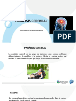 Parálisis cerebral: causas, tipos y métodos de tratamiento