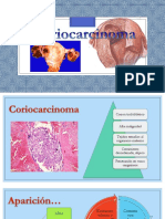 Coriocarcinoma 140914211928 Phpapp02