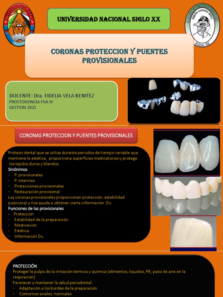 Provisionales dentales tipos, funciones, materiales y técnicas de