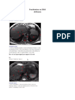 Pondération en IRm Abdomen