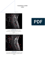 Pondération en IRm Rachis