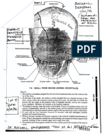 Parietal foramen location