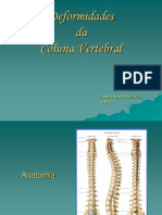Deformidade_Coluna_Vertebral