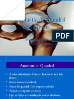 Artroplastia de Quadril Aula