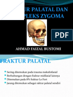 Fraktur Palatal Dan Kompleks Zygoma