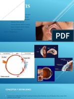 Presentacion Uveitis