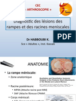 Diagnostic Des Lésions de La Rampe Méniscale