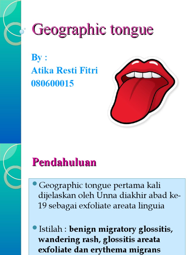 Geographic Tongue