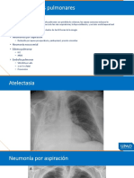 t4 MEHU107 - U2 - T4 - COMPLICACIONES PO NO INFECCIOSAS - PART2