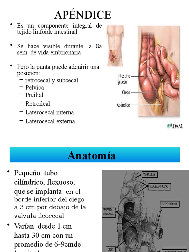 APENDICITIS