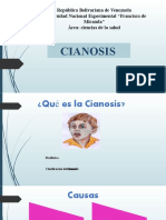 Cianosis