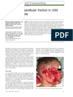 Comminuted Mandibular Fracture in Child Victim of Dog Bite