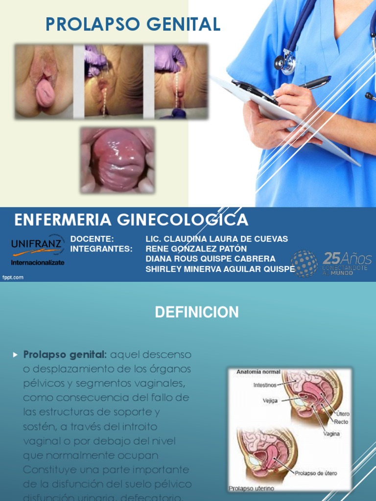 Prolapso Uterino | PDF | Vagina | Parto