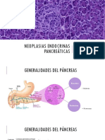 Neoplasias Endocrinas Pancreáticas