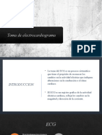 Electrocardiogram A