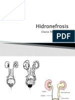 Hidronefrosis