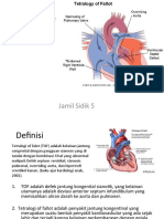Tettralogi of Fallot (Autosaved)