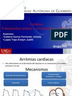 Arritmias Extrasistolica Sinusal y Ventricular