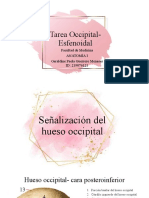 Tarea Occipital - Esfenoidal1