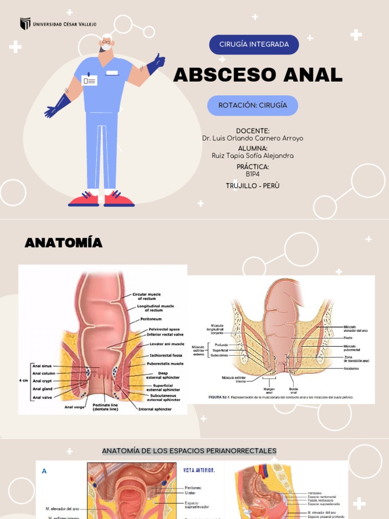 Abceso Anal - B3P4 | Descargar gratis PDF | Enfermedad de Crohn ...