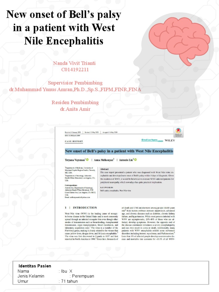 Case Report Bells Palsy | PDF