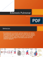 estenosis pulmonar definitivo