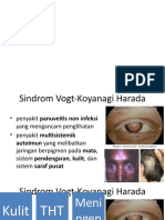 Sindrom Vogt Koyanagi Harada-Glaukoma Akut